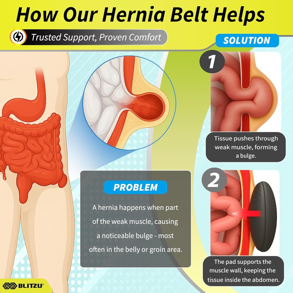 blitzu-umbilical-hernia-belt-for-men-wom-5.jpg