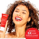 colgate-optic-white-stain-fighter-teeth--3.jpg
